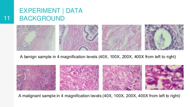 VietAI Summit Detection and Classification of Cancer